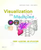 Visualization in Medicine -Theory, Algorithms, and Applications